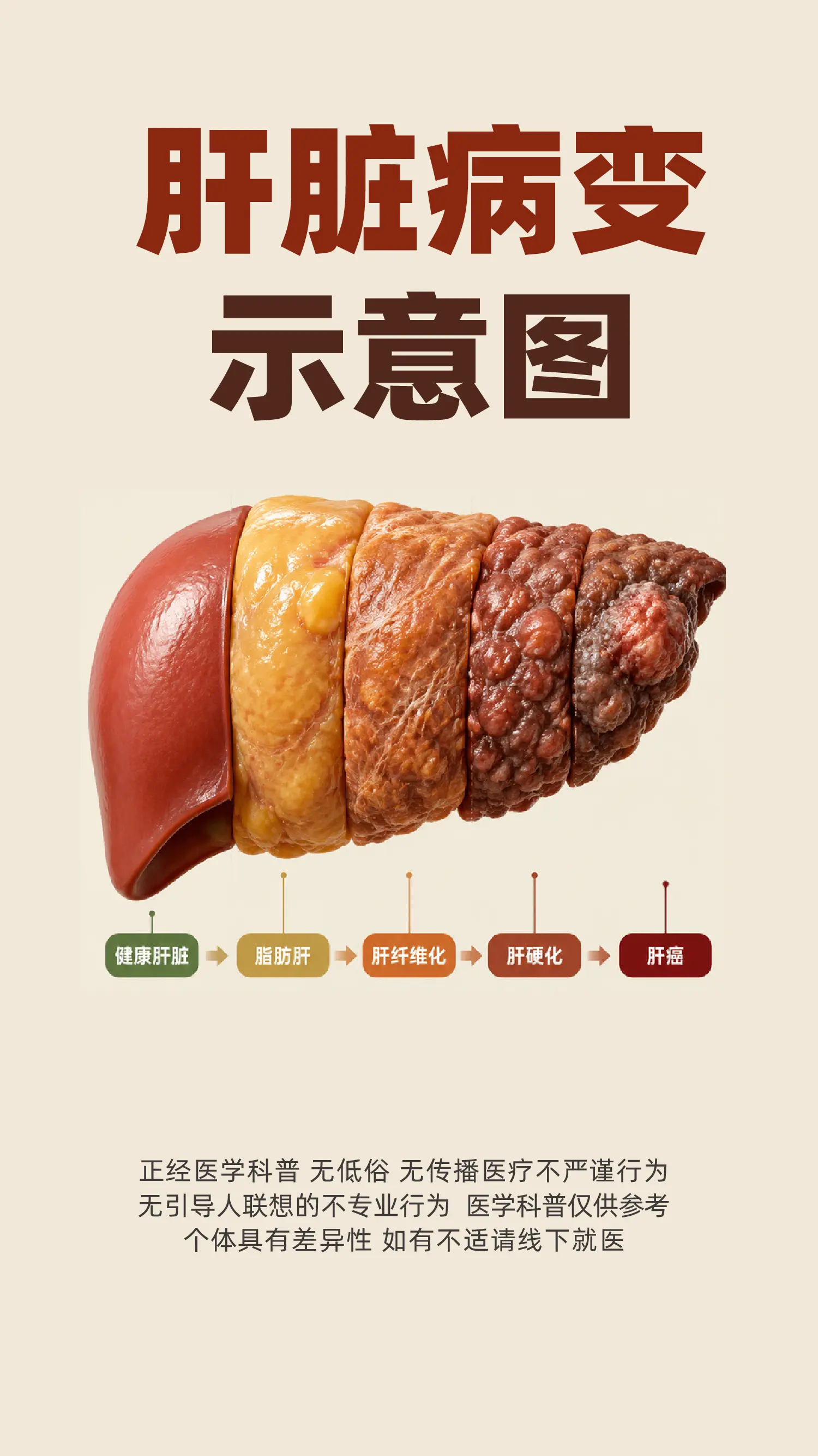 肝脏病变示意图。