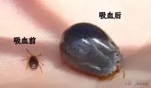 73岁老人体内惊现17只“夺命虫”！医生紧急提醒：千万别硬拔，这个动作最致命