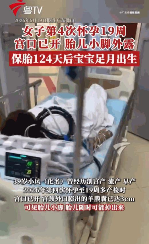 “希望母子平安！”广东佛山，一位39岁的高龄产妇，在怀孕19周时，宫口竟然已经大