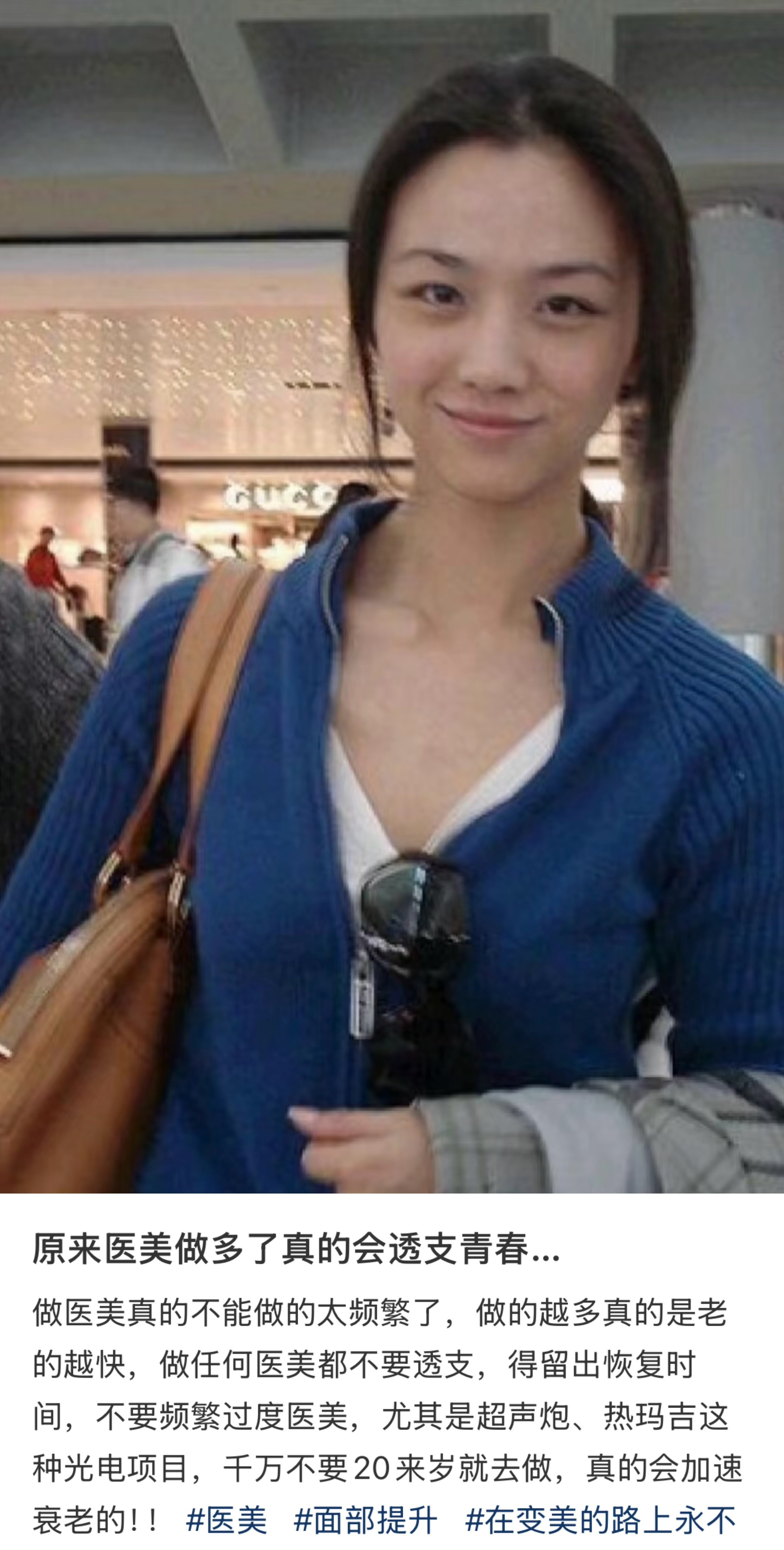 原来医美做多了真的会透支青春……​​​