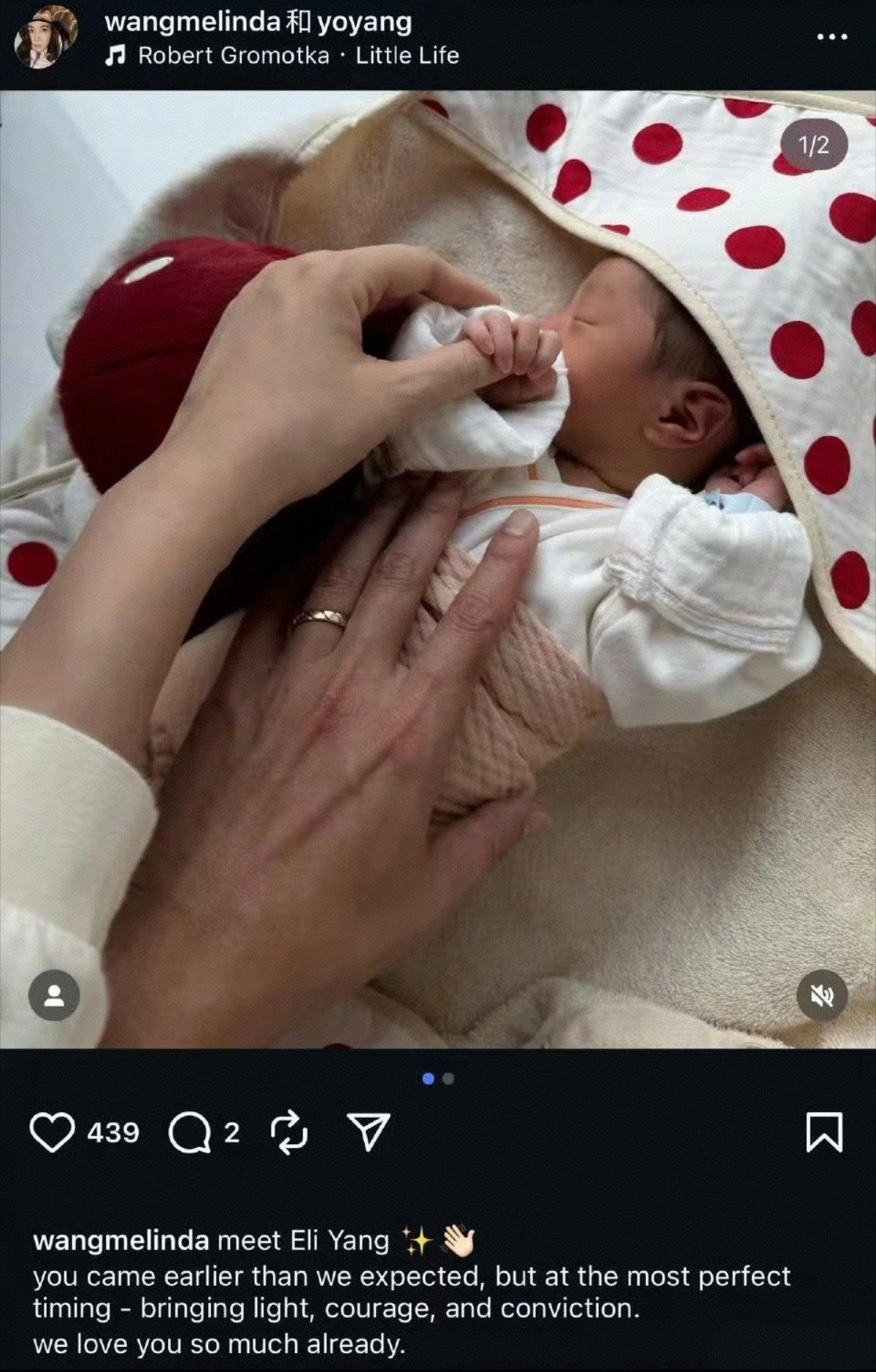 杨祐宁和老婆阿梅宣布三胎生了，看手环颜色，应该是儿子。恭喜，儿女双全