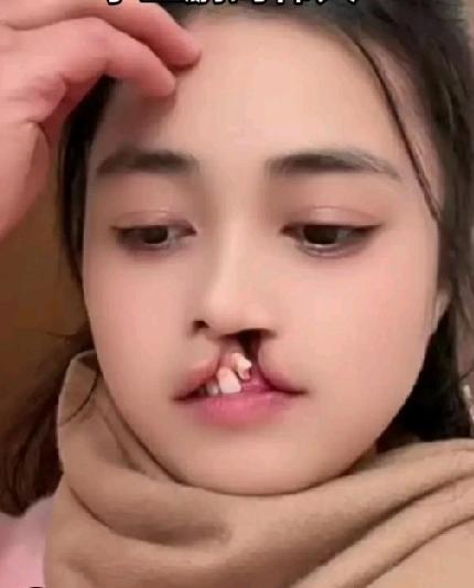 她，浓眉大眼，头发清秀发亮，皮肤白净，美丽可爱。遗憾的是嘴巴有点缺陷……