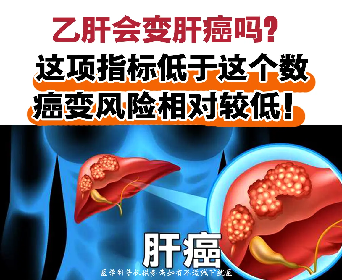 很多乙肝患者常年被一个问题困扰：“乙肝会不会最终变成肝癌？” 其实临床...