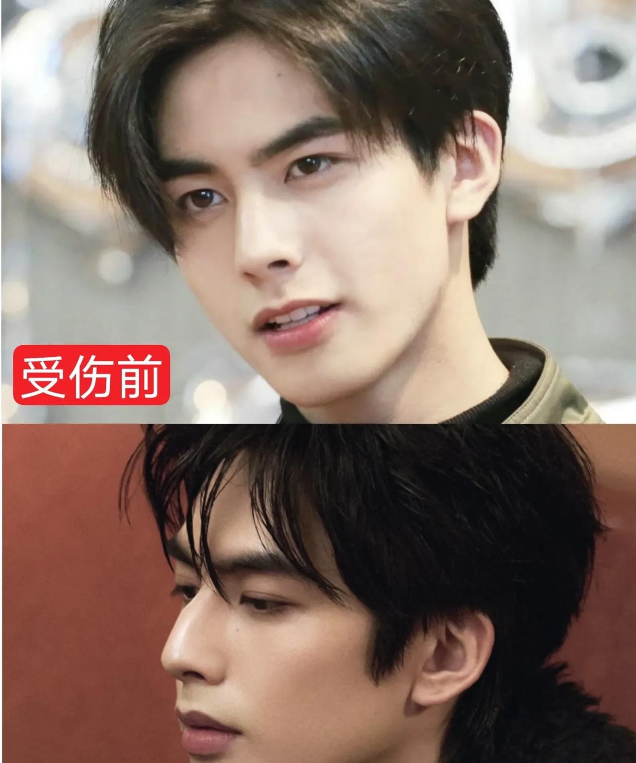 大家都在讨论宋威龙的鼻子，才知道他的鼻子在拍打戏时受过伤16岁出道时，宋威龙还