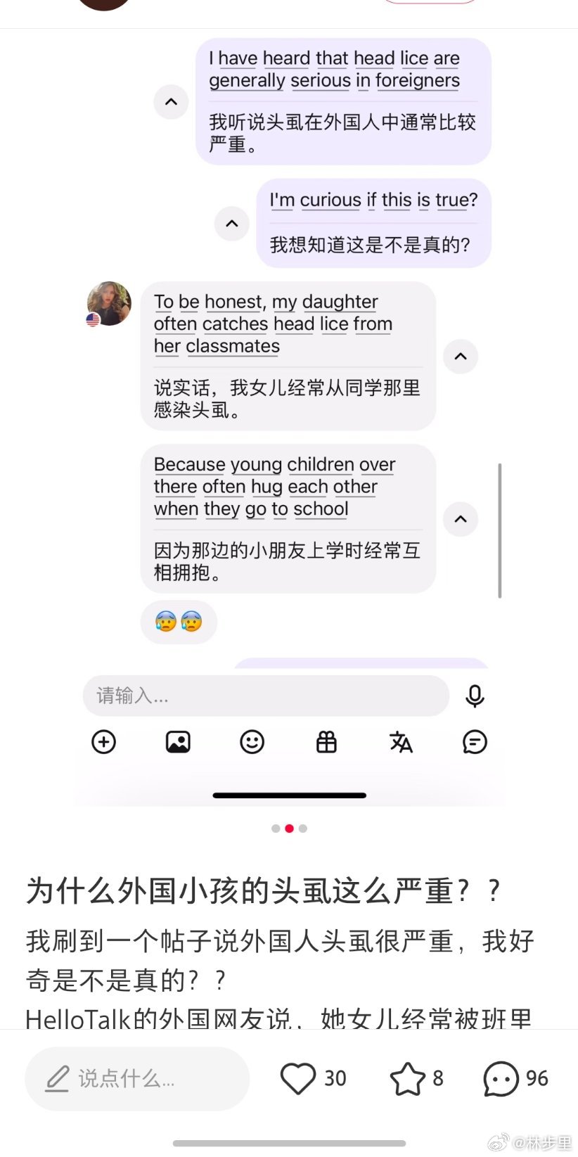 “为什么外国小孩的头虱这么严重？？”因为外国人脏，老外不讲卫生。我对头虱的印象还