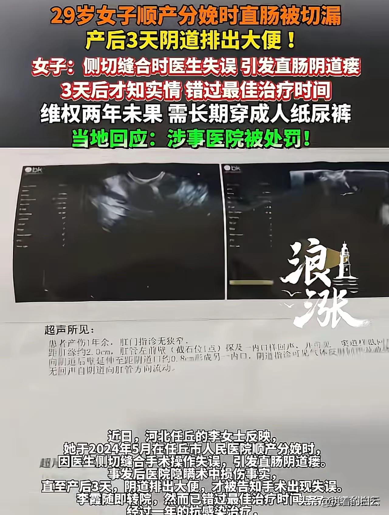 29岁妈妈顺产成噩梦：直肠缝漏阴道排便，医院隐瞒致终身伤痛