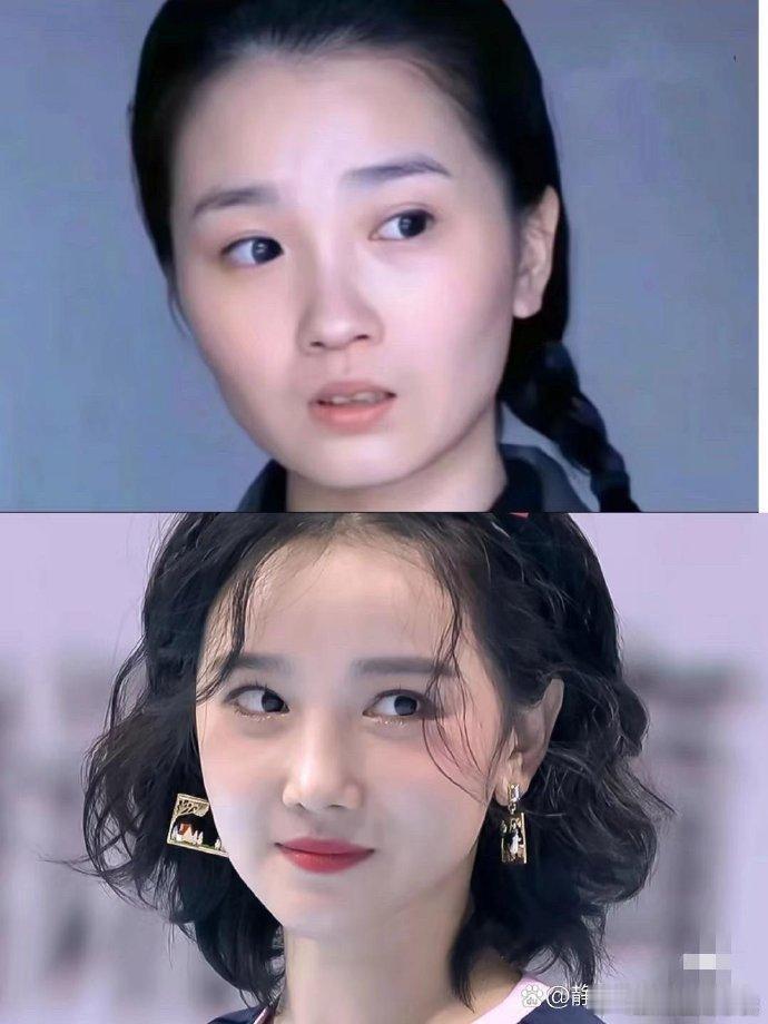 陈小纭的美商是相当在线的，面部微调之后，整个人好看太多了