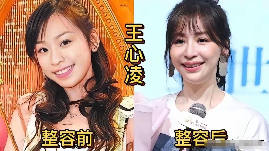 大大方方直面医美，其实是一种坦然。如今整容早已不再是带有贬义的标签，更像一个中性