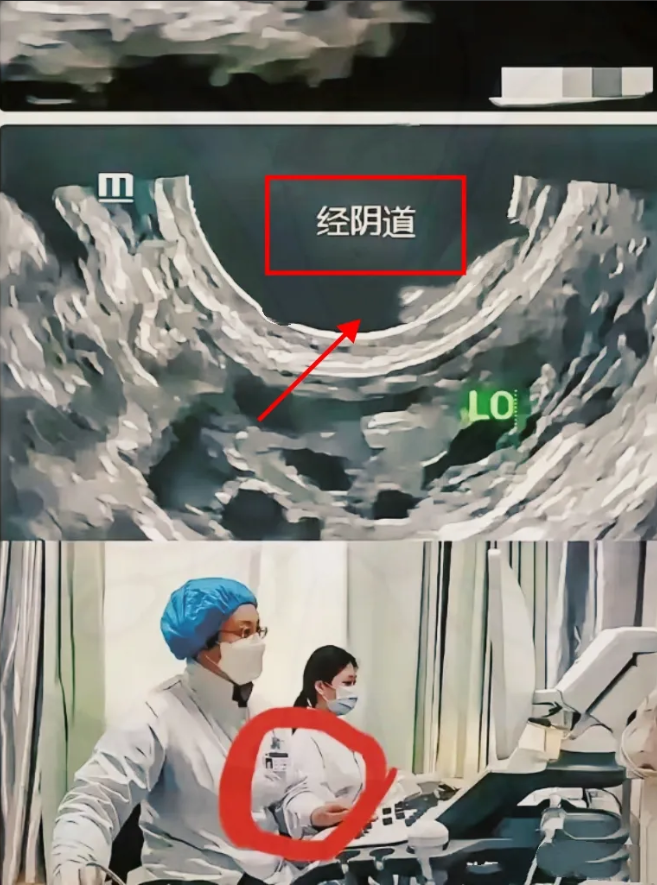 这啥事儿啊，简直震碎三观！王女士因为身体不舒服去医院检查B超，结果医生给她做