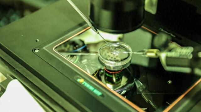 上海科学家再登《细胞》: 首次发现大脑“排污网络”发育调控的秘密