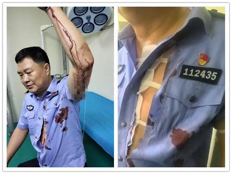 泪目！民警硬抗尖刀，30针缝合太揪心9月13日，内蒙古巴彦淖尔一男子王某某