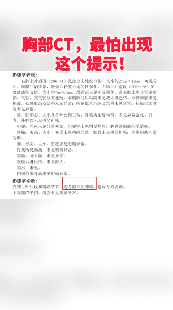作为一名中医肿瘤专家，别能理解患者现在的心情 ,不过先不要着急，竟然查...