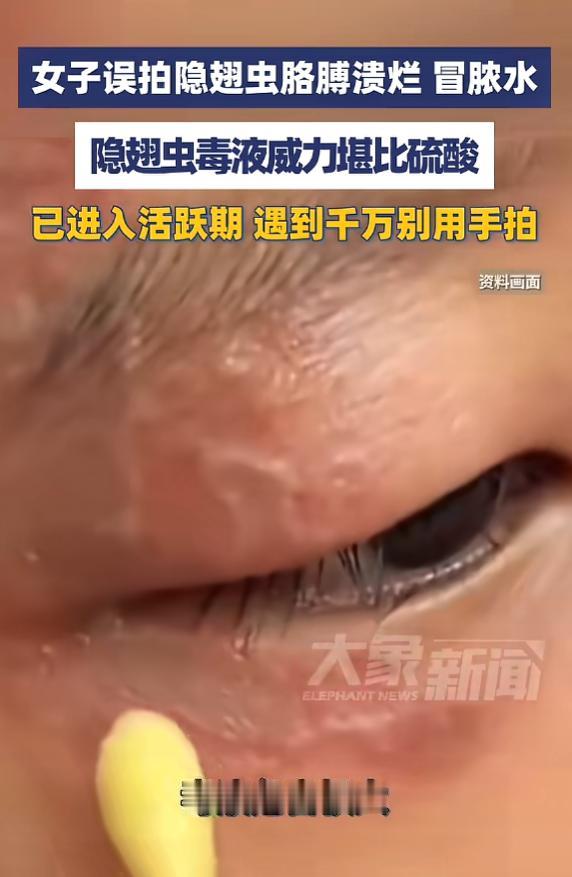 “悲剧还是发生了！”5月28日光明网报道，浙江义乌，一女子看到窗边有小虫子，随手