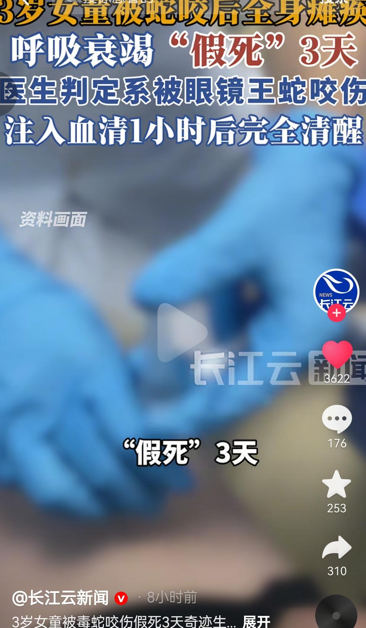 泪目了！3岁小女孩被剧毒眼镜王蛇咬伤，全身瘫痪、呼吸衰竭，整整“假死”3天，最后