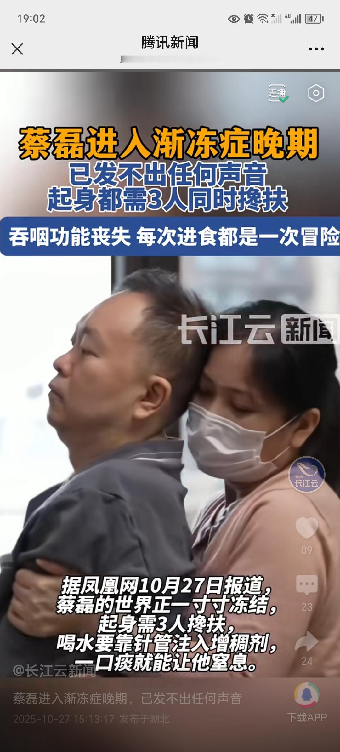 蔡磊已经进入晚期了!全身只有眼睛能动了,要靠3人搀扶,躺下要拍打按摩身体才能缓