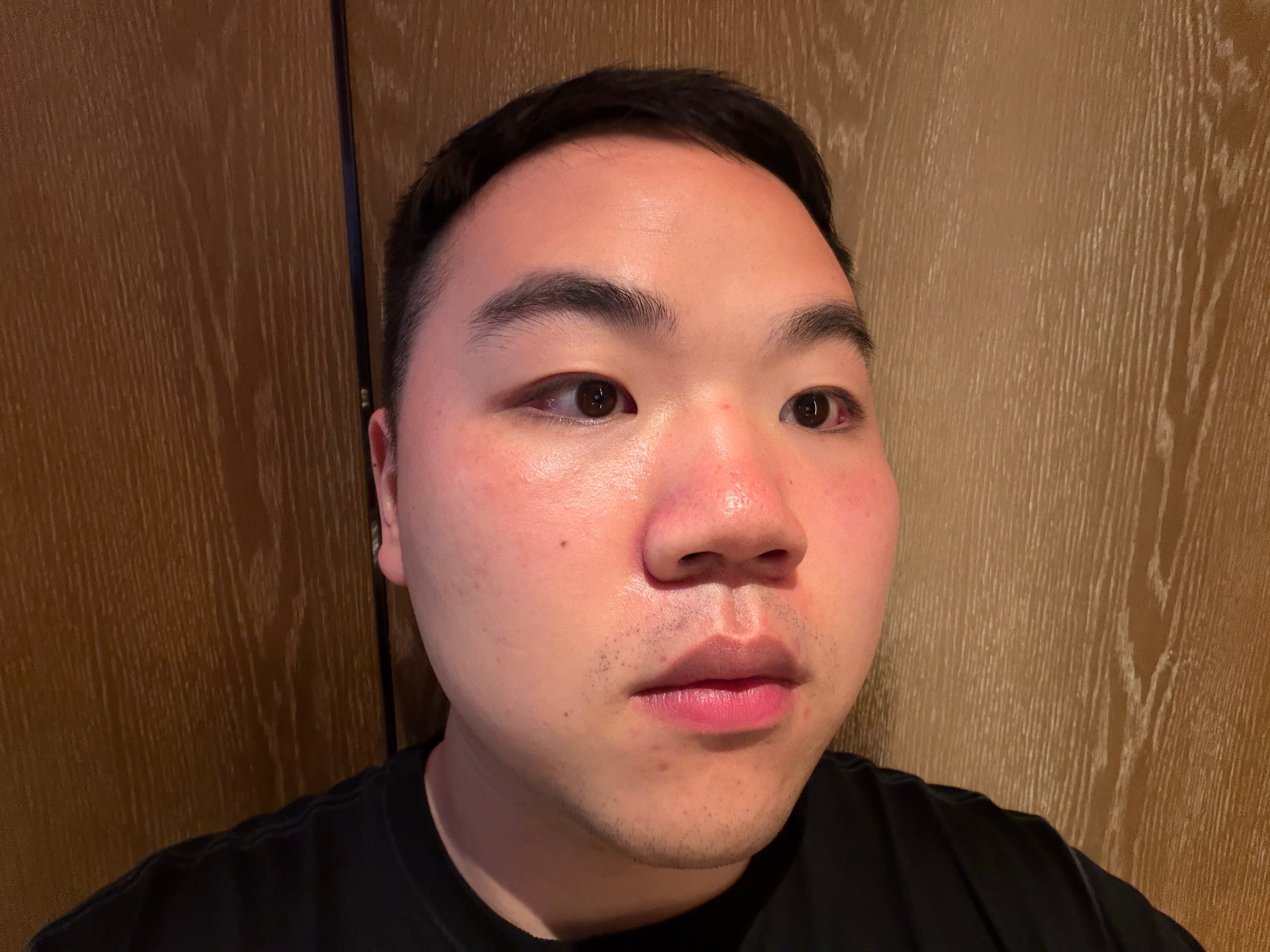 冷白皮的缺点：半个小时就可以晒伤，看起来还像微醺