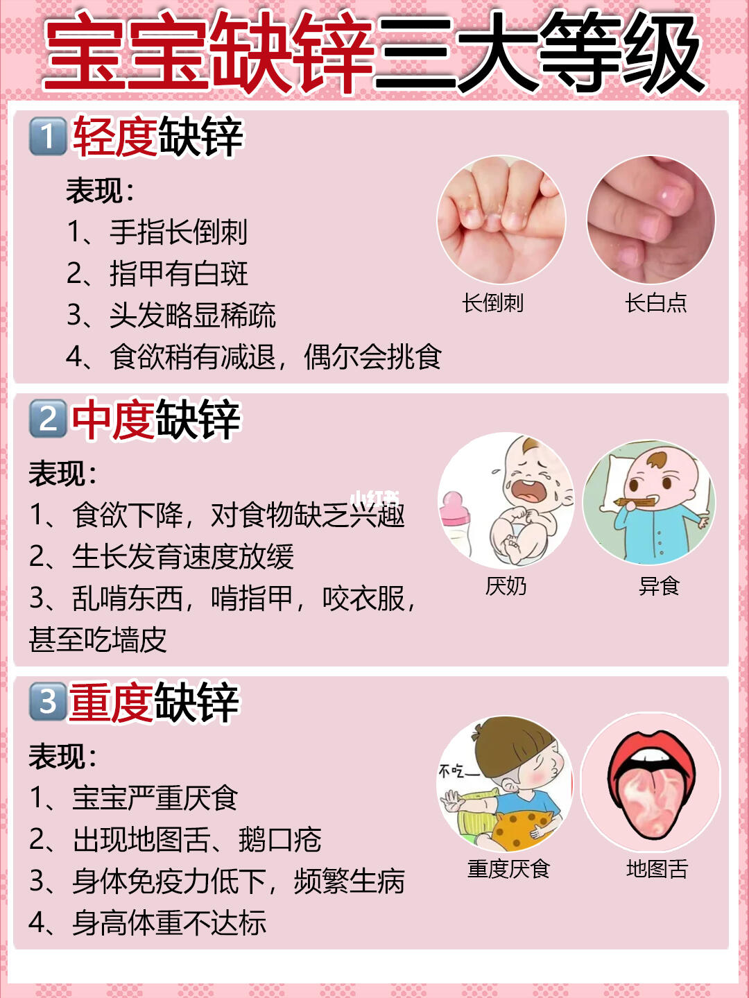 宝宝缺锌三大等级，赶紧给宝宝自查！！