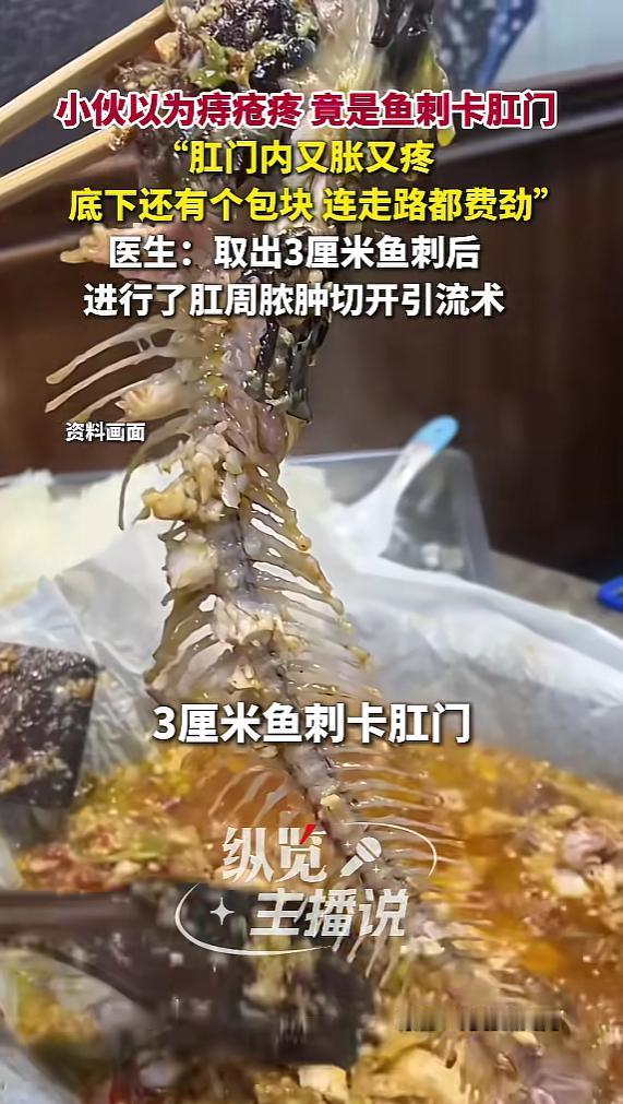 “丢人丢大了！”近日，广东，一男子肛门又胀又疼，以为是痔疮犯了，可这几天越来越疼