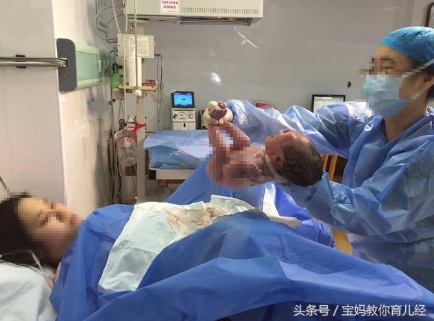 新生儿出生10天却仍无法睁眼, 紧急就医后, 医生却哈哈大笑