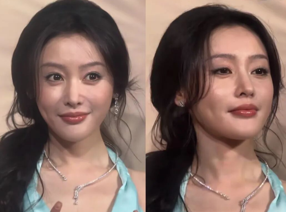 苹果肌千万别乱填啊！张天爱你究竟对自己美丽的脸做了什么！都把自己整成叶珂2.