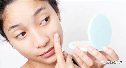 脸上反复长痤疮的护理措施有哪些?