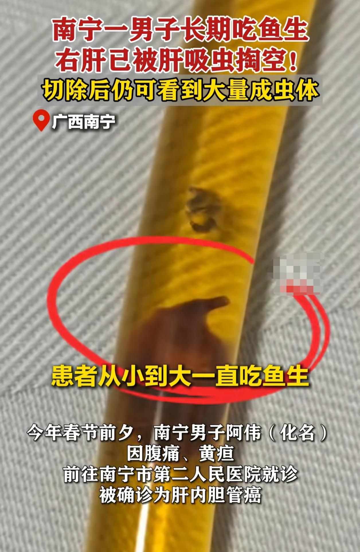 就因为好这口，最后肝都被“掏空”了！前段时间，广西南宁的一名男子，皮肤眼睛看