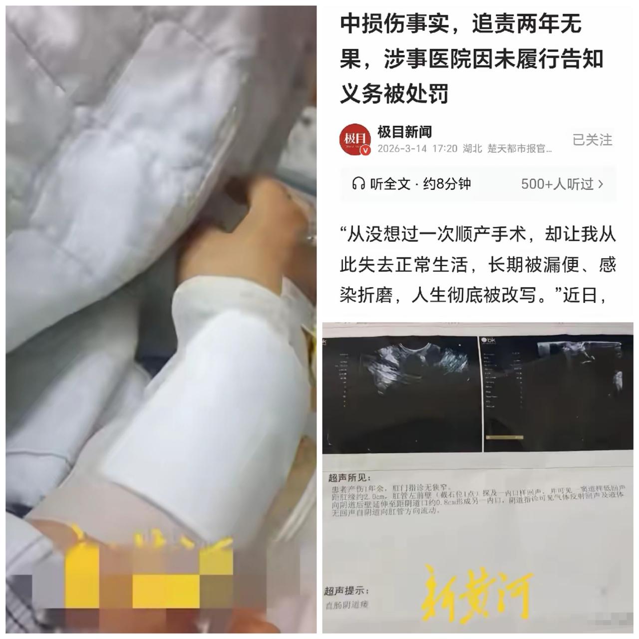 河北女子产后阴道排便，医院隐瞒真相，医生仍在岗！医疗责任警钟谁来敲响？