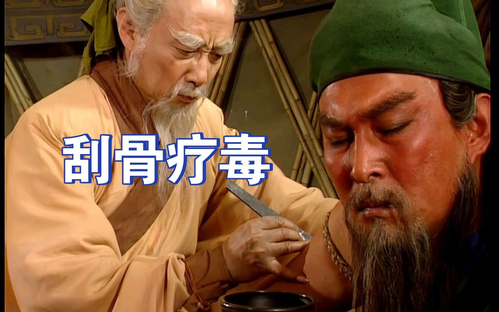 历史知识今天刷到一个很野的野史：据说，当年刮骨疗毒时，华佗一边拿刀刮毒一边问关羽
