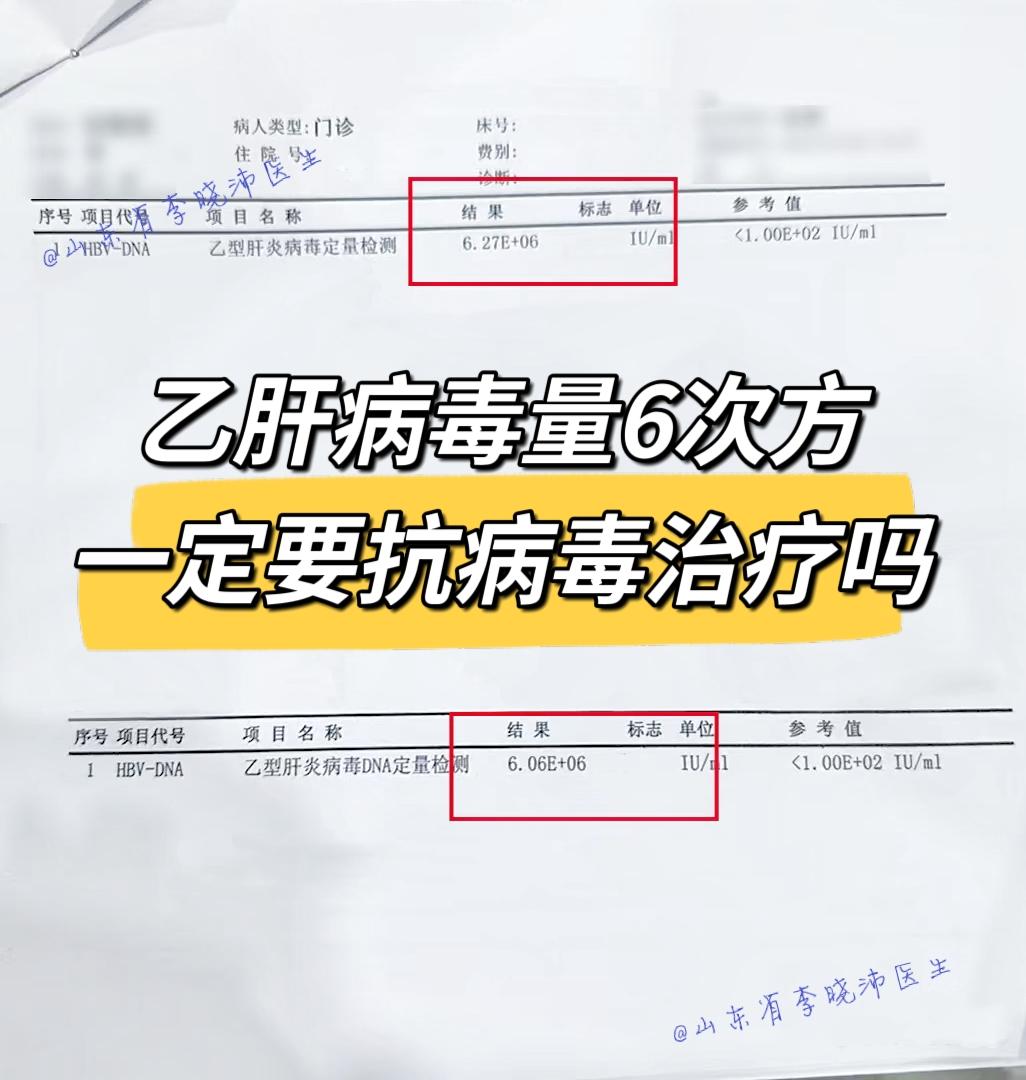 乙肝病毒量高到6次方 ！这是我上午的一个病号的单子，6次方的病毒量，说...