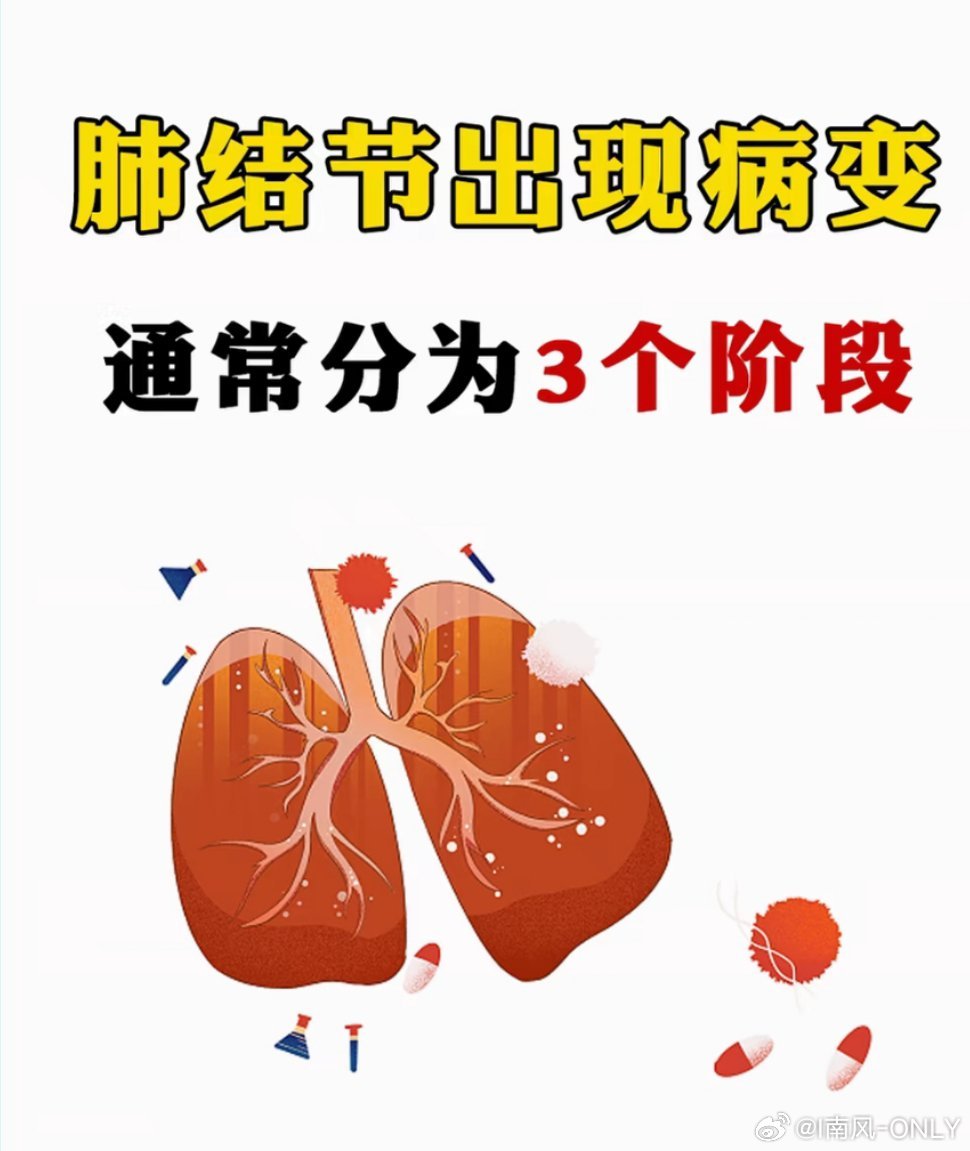 医生建议40岁以上人群定期筛查这种癌肺结节的大小与癌变风险之间的关系如下：1.