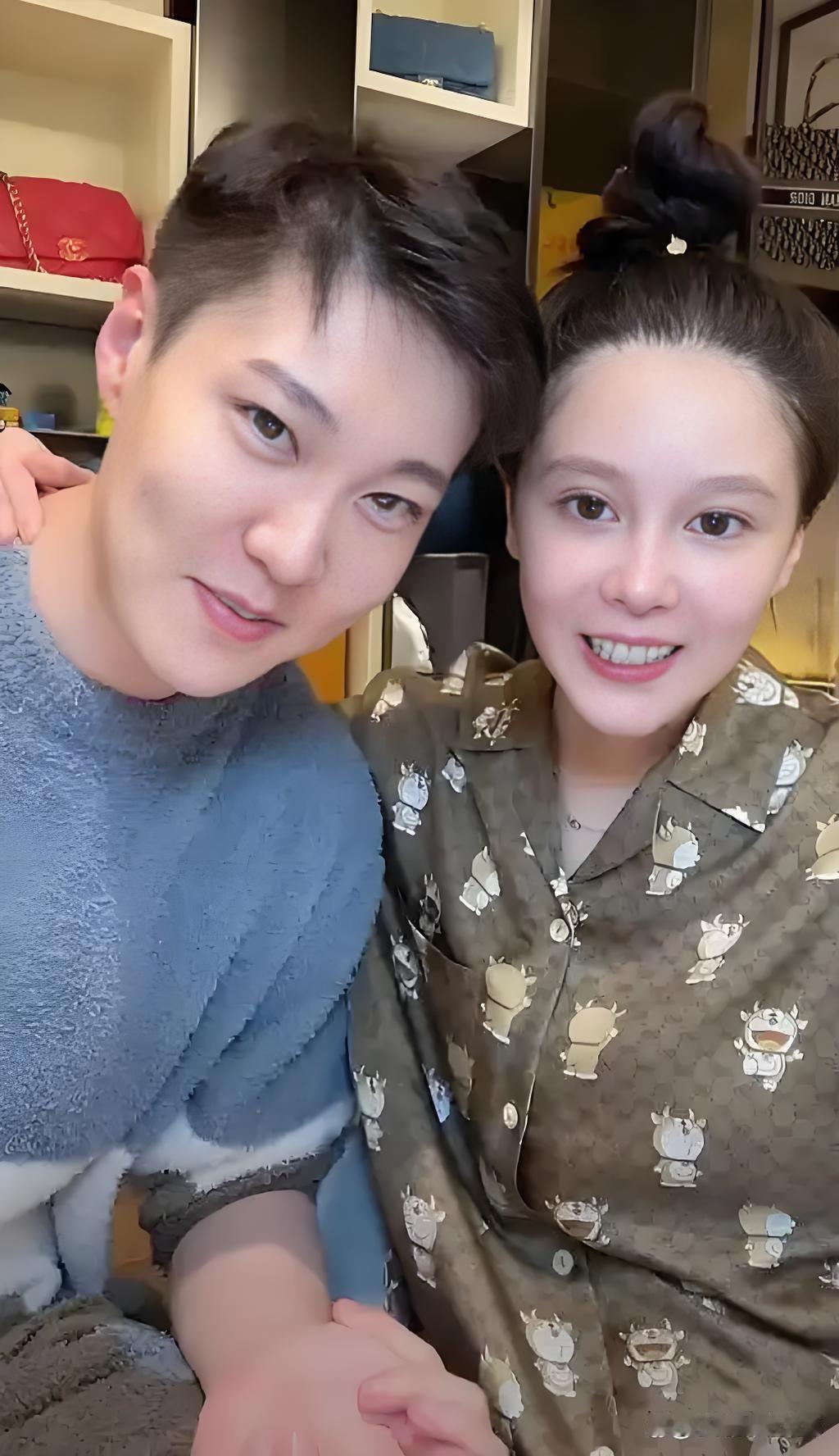 好多人都说赵本山的女婿整容了，人家自己有钱，想变好看点，有什么可诽议的。男人也有