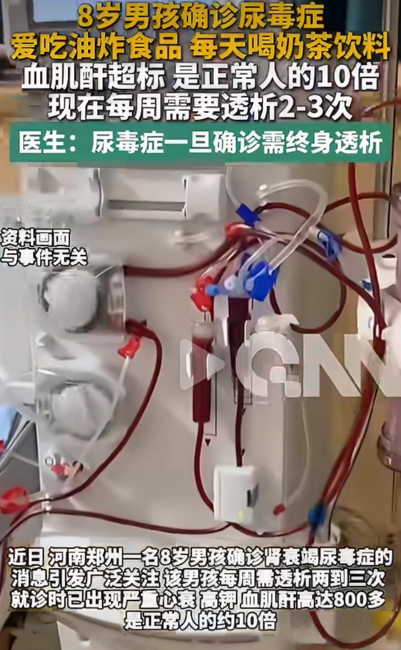 谁能想到，活泼的孩子突然恶心呕吐、全身浮肿，送医检查直接确诊终末期尿毒症。孩子血