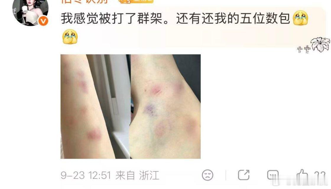 以后什么都打码，毕竟啥都偷！！！！​​​