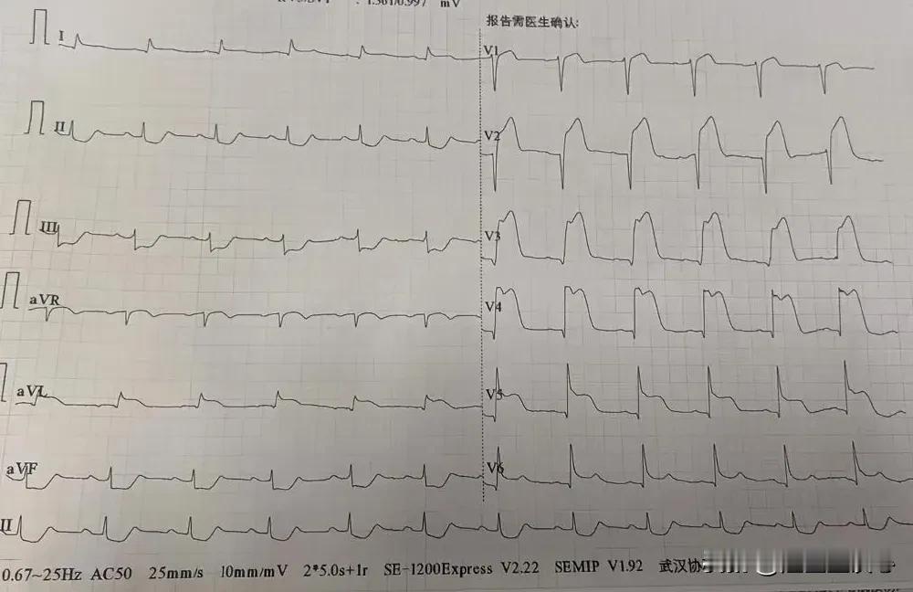 上周六早上还在睡懒觉，被一阵电话吵醒，说是有一个本院医生的亲戚突发急性心肌梗塞，