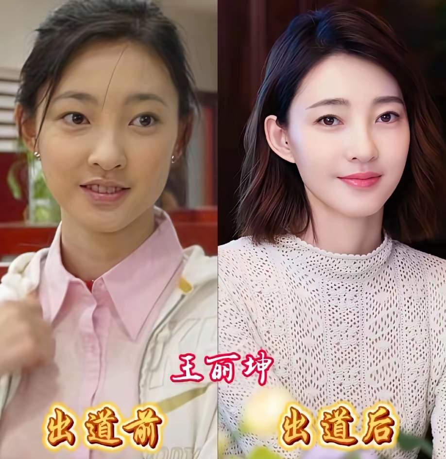 女星出道颜值反差合集！谭松韵堪称原生颜值天花板，从青涩少女到当红女演员，长相几乎