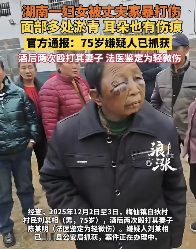 湖南女子遭75岁丈夫家暴：两天两顿打致精神失常，儿子的无奈戳中无数人心本应