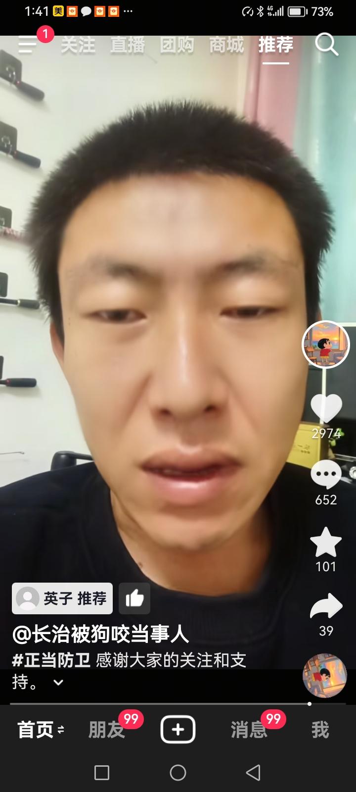 山西长治狗咬人事件在5月26在山西长治开庭，一审离二婶时间过去五个多月了，这件事