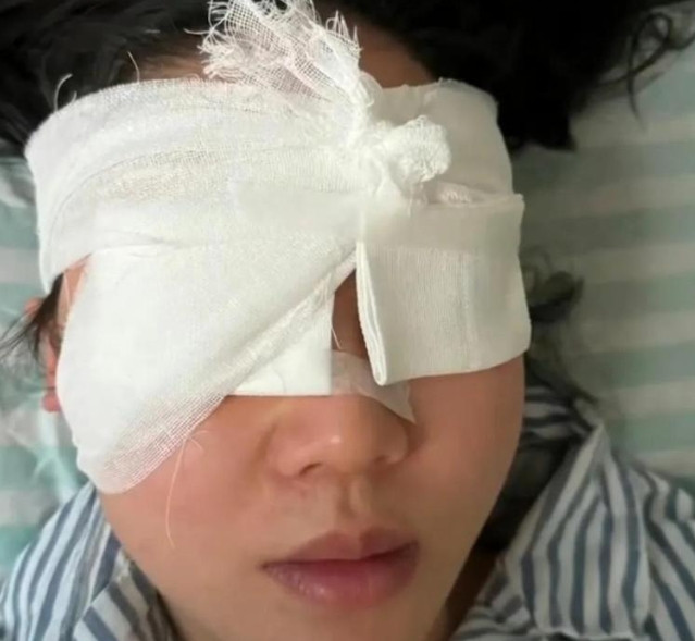 女子漂流被射瞎，30万想私了？景区沦为“帮凶”，官方终于出手了！