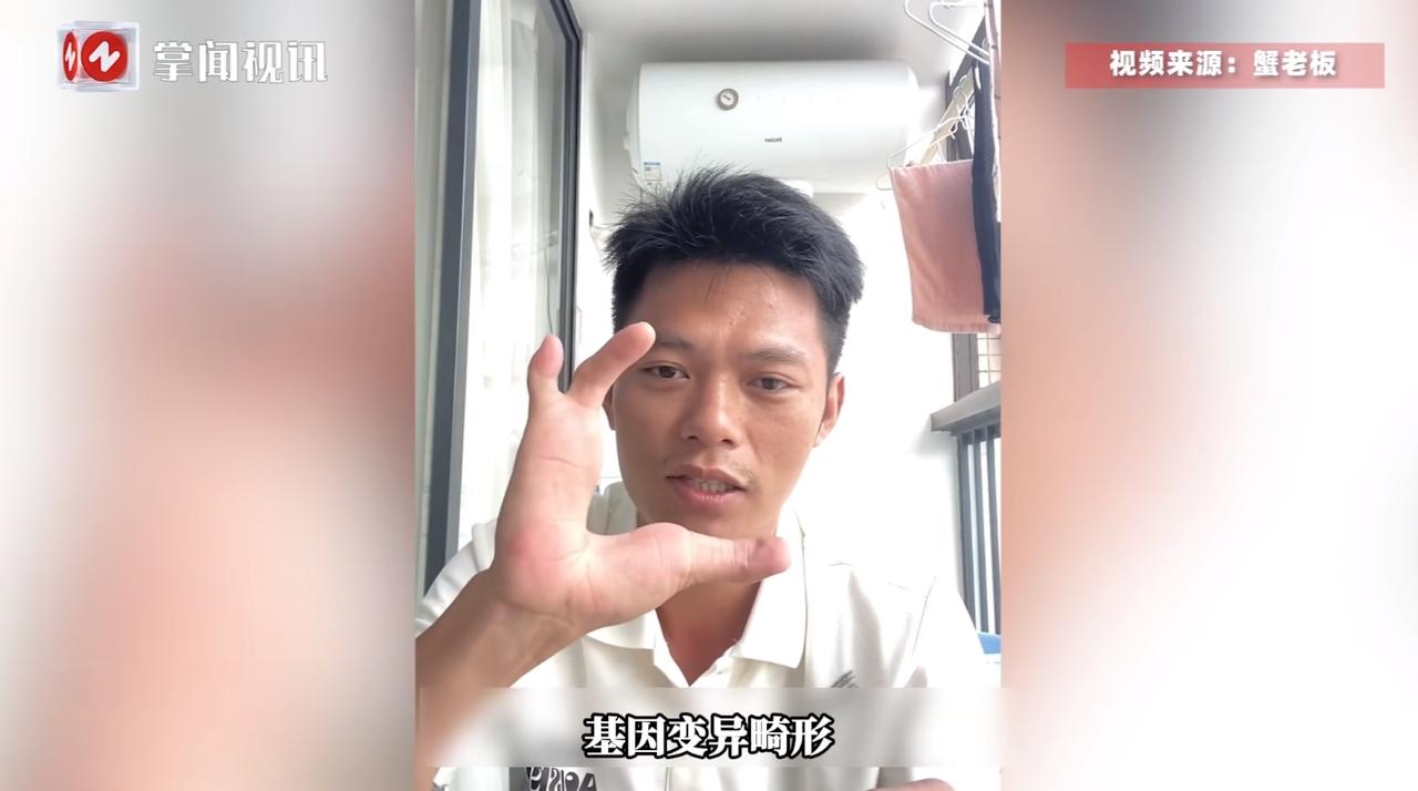 悲剧还是发生了！湖南，一男子的外公外婆是堂兄妹的关系，因为近亲结婚导致生出来的4