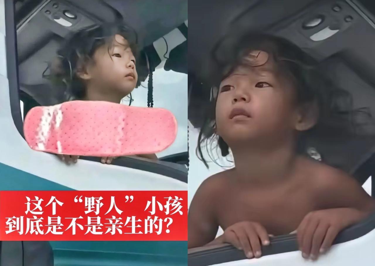 这“野人小孩”，模样挺帅，眼神里透着股坚毅劲儿，可现状真让人心疼。孩子脊椎可能都