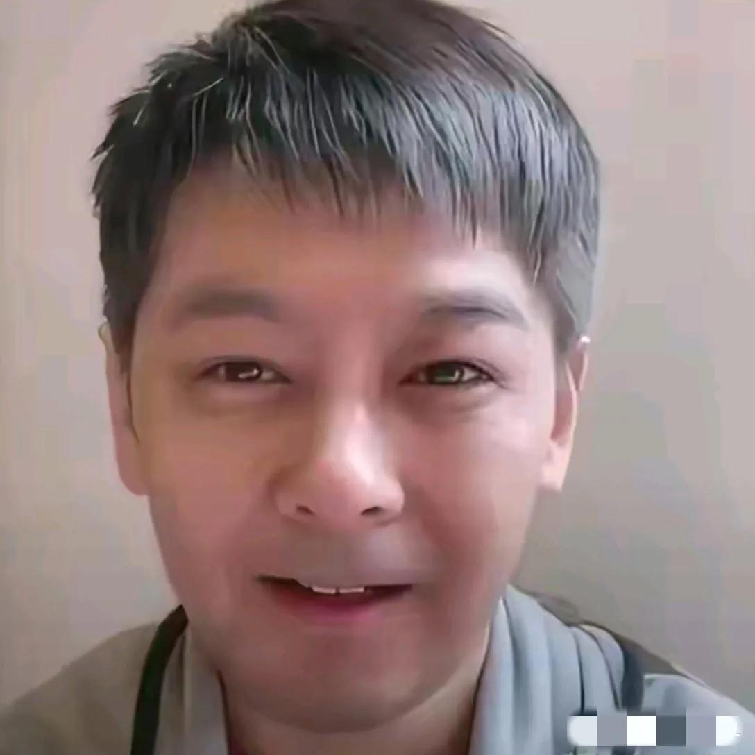哇塞，不老男神林志颖也模样大变：头发稍显花白，眉膀眼肿，面孔馒化，鼻梁塌陷，终于