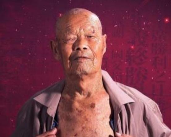 1956年，35岁农民，咳嗽10年，拒绝就医，一天，他突然用力咳嗽，“哇”的一声