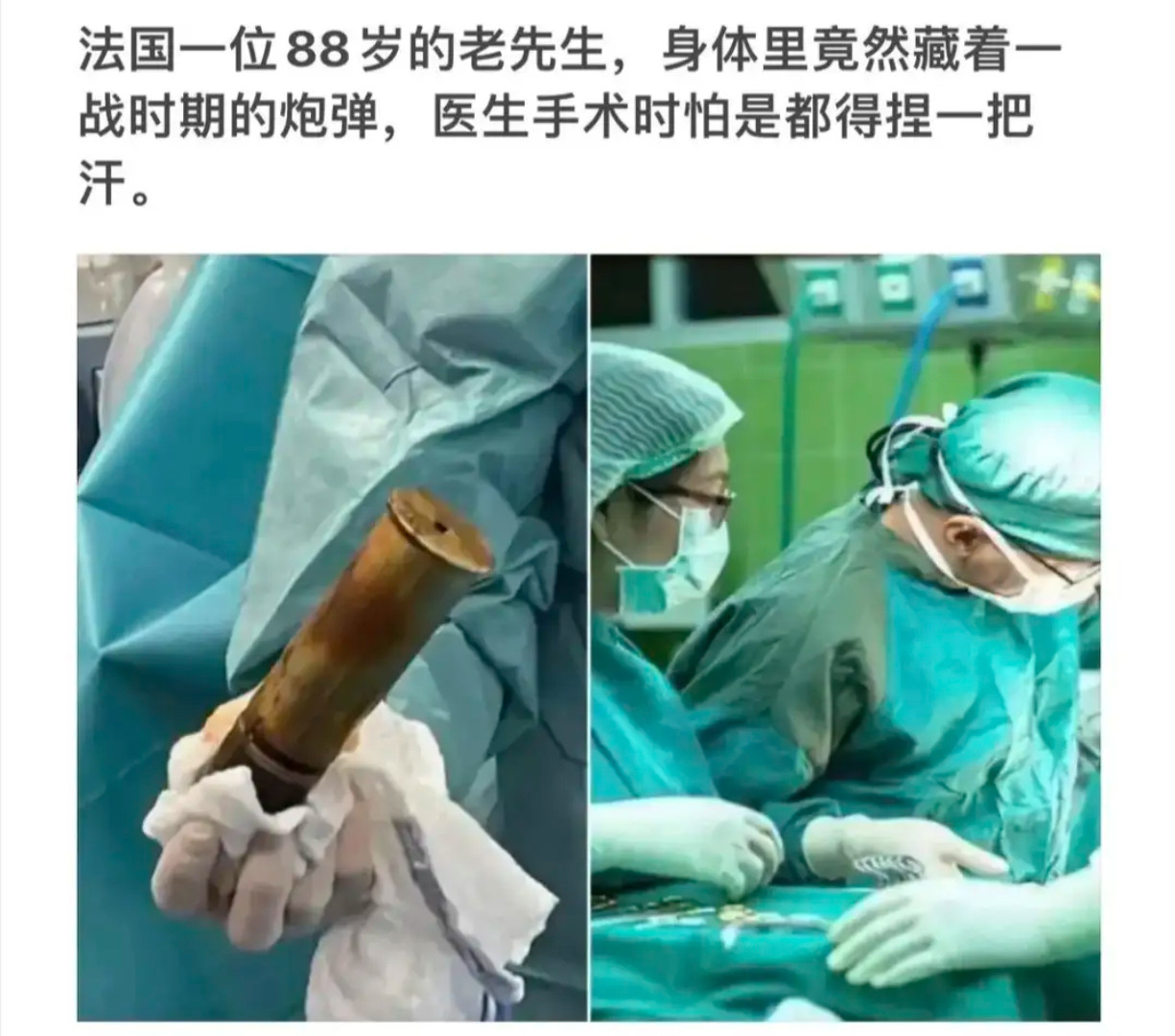 一战炮弹在88岁老人体内，这场手术堪称“步步惊心”​​​