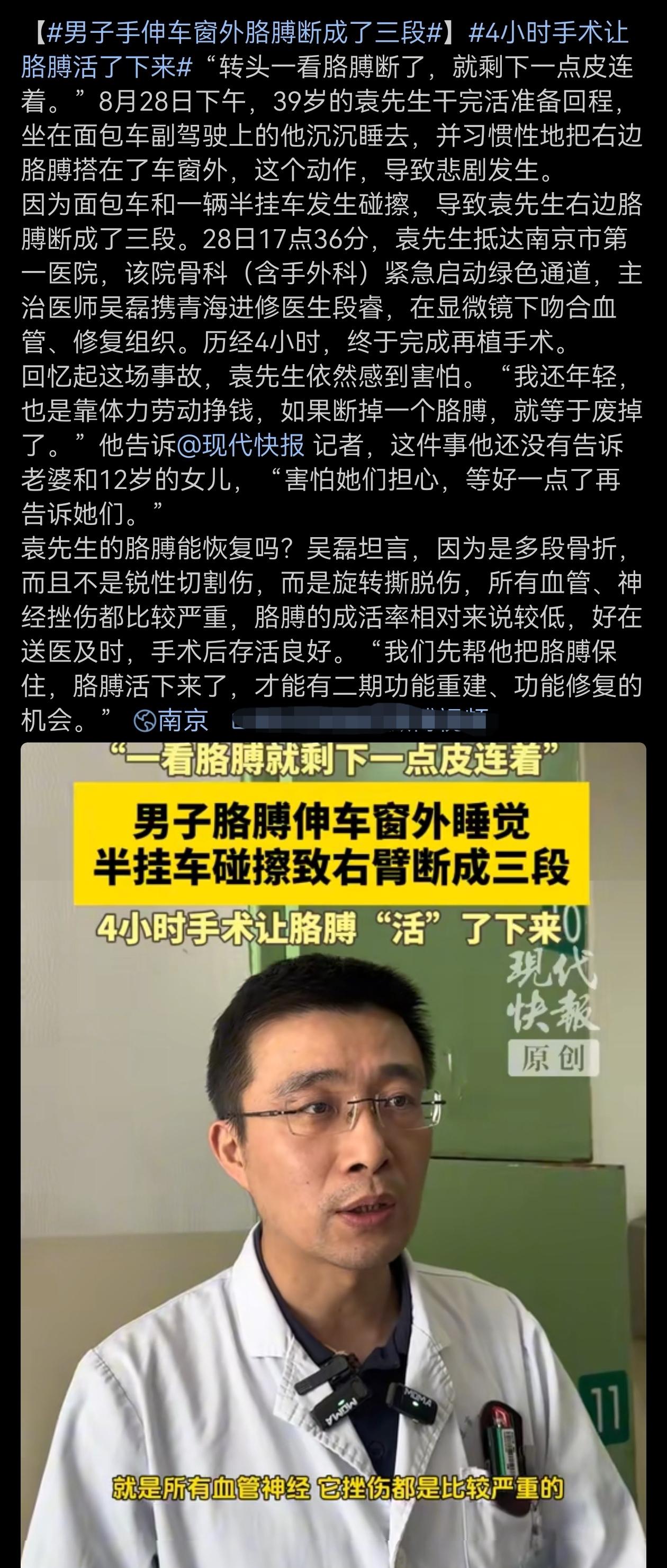 看着都疼，开车、坐车，身体部分千万不要露到车厢外面，太危险了！