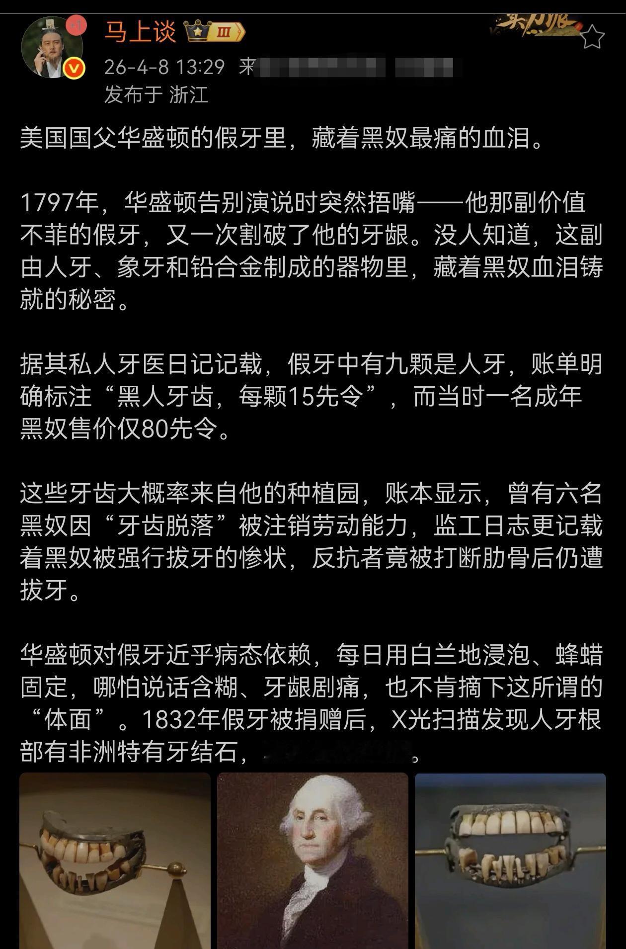 瘆得慌。美国国父华盛顿的假牙里，藏着黑奴最痛的血泪。