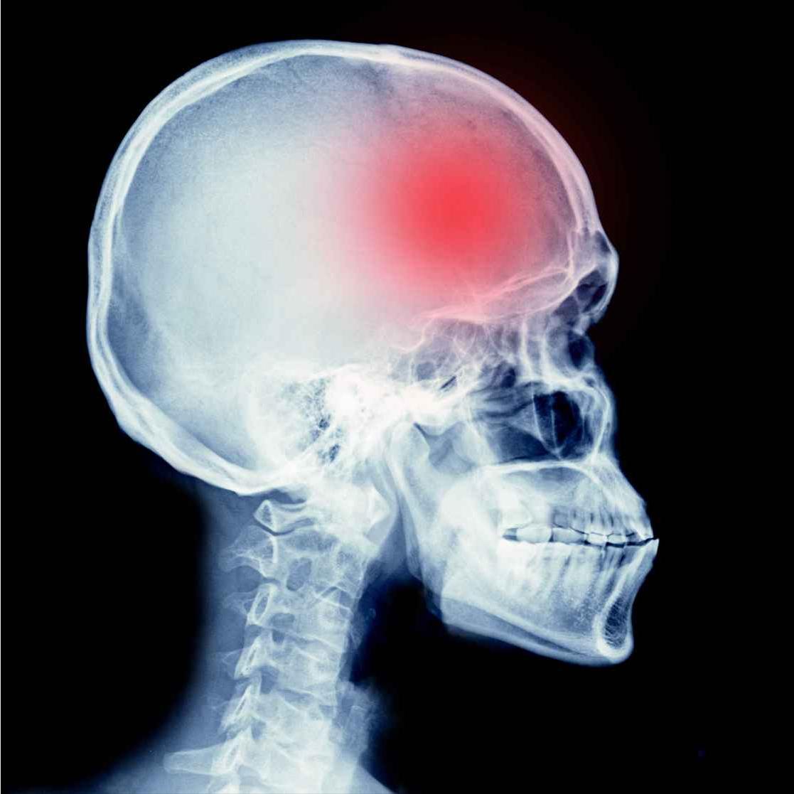 6个突然出现，是脑血栓的最后警告！脑血栓发生前，身体往往会发出明确的求救信号。