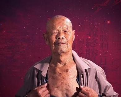 1956年，35岁农民，咳嗽10年，拒绝就医。一天，他突然用力咳嗽，“哇”的一声