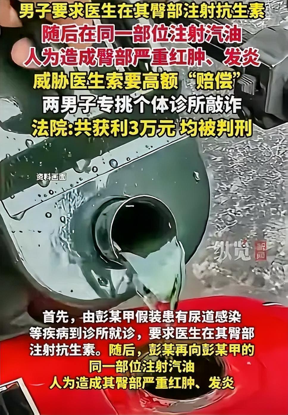 我的天亲兄弟为骗钱竟互相注射汽油坑医生这俩货真是脑子长歪了放着正道不走