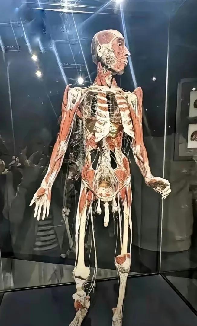 让大家见识一下男女标本。图1是一具20岁男青年的遗体，他死在建筑工地上，他的父母