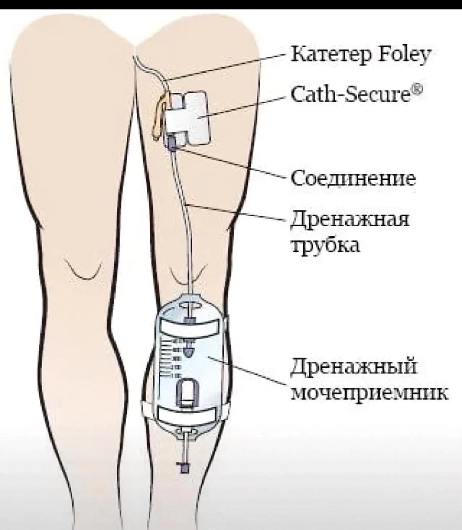 特朗普腿上藏“神秘物件”？这瓜刚冒头就变味了！最近传得有鼻子有眼，说美媒拍